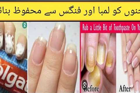 Nail care  whitening and shinning | fungal infection removal remedy | beauty tips