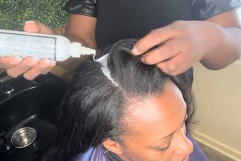 Rescue Mission: Overcoming Hair Shedding & Dandruff After a Relaxer-got a relaxer now it’s..