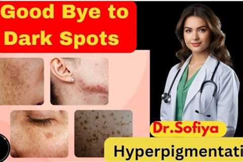 Dark Spots Kaise Hatayein: Ultimate Hyperpigmentation Treatment Guide| Best Tips & Secrets..